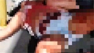 Mulher é morta com facada no pescoço ao revelar gravidez