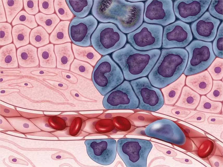 Descoberta proteína que ajuda câncer a se esconder das defesas do organismo