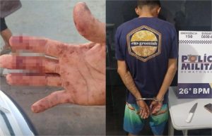 Homem tem os dedos cortados ao defender amiga de roubo em MT