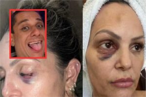 Juíza manda colocar tornozeleira eletrônica em policial que espancou personal em MT